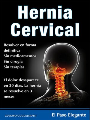 Hernia cervical - ebook